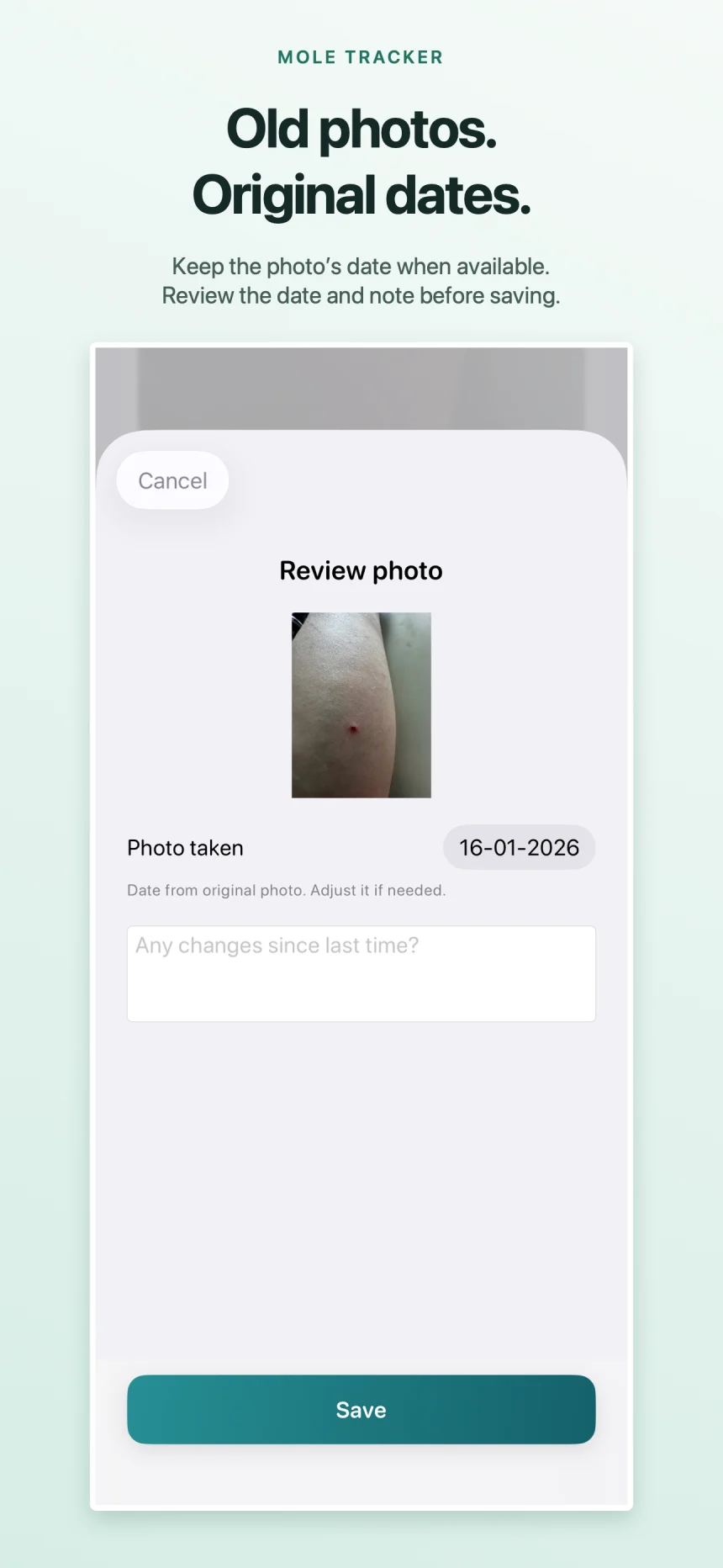 Mole Tracker's Review photo screen with a photo, editable original date, note field and Save button.